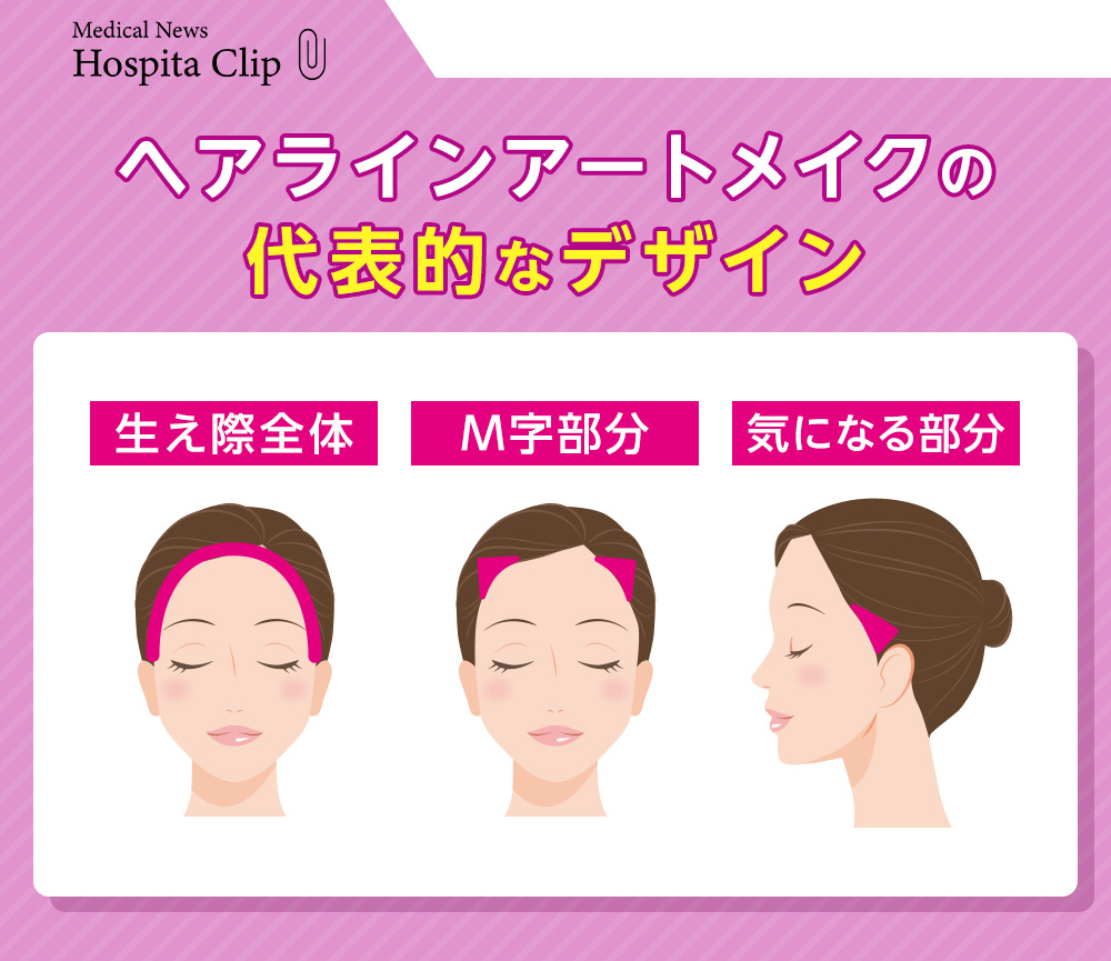 ヘアラインアートメイクの代表的なデザイン