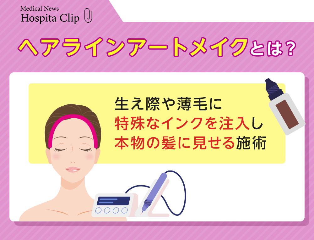 ヘアラインアートメイクとは