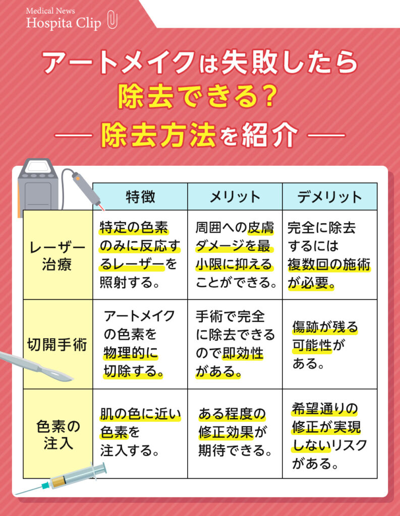 アートメイクは除去できる?