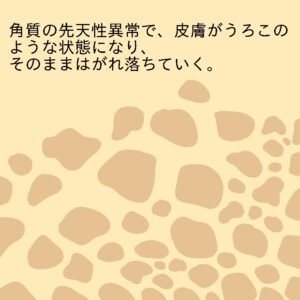 魚鱗癬とは ホスピタclip公式
